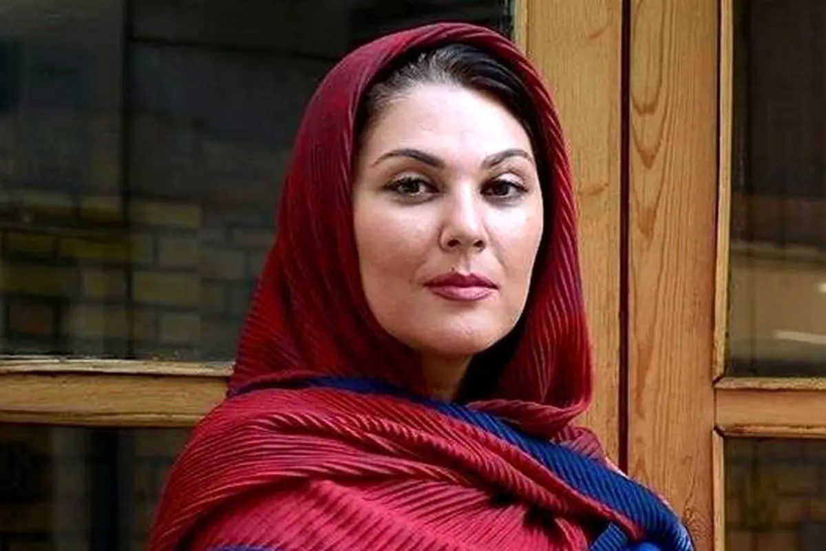 تغییر چهره لاله اسکندری بعد از عمل زیبایی