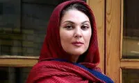 تغییر چهره لاله اسکندری بعد از عمل زیبایی