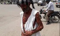 بیماری عجیب مرد حبابی (16+)
