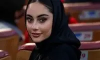 ترلان پروانه تغییر چهره داد و جنجال به پا کرد!