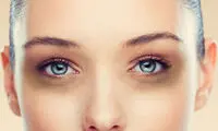 اگر سیاهی دور چشم زندگیتان را سیاه کرده...