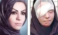پدرشوهر اسیدپاش پای میز محاکمه می رود