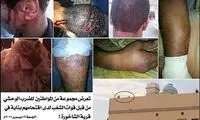 شکنجه مردم درب منزل ! + عکس