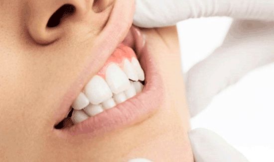 بهترین متخصص زیبایی دندان را چگونه انتخاب کنیم؟