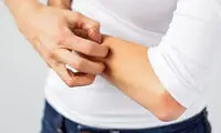 آلرژی مرکبات چیست و چه علائمی دارد؟