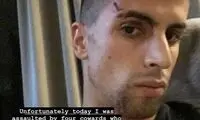 زخمی‌شدن ستاره سیتی پس از سرقت از منزلش