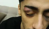 ضرب و شتم ملی‌پوش ژیمناستیک ایران!