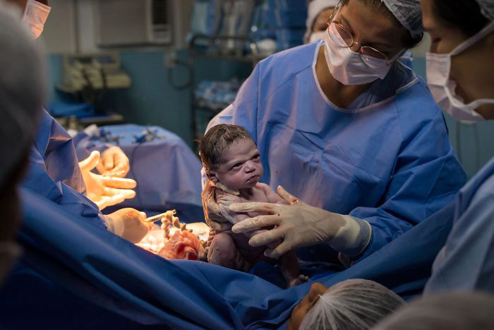 نگاه عجیب این نوزاد هنگام تولد، جهانی شد!