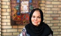 زنی که صورتش را بارها جراحی پلاستیک کرد