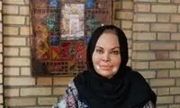 زنی که صورتش را بارها جراحی پلاستیک کرد