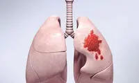 عکس: تبلیغات بسیار جالب و خلاقانه (90)