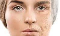 علائم پیری زودرس پوست چیست؟