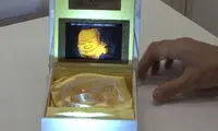 لبخند جنین خود را قاب کنید +عکس