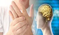 شایع‌ترین نشانه‌ای که از ام اس خبر می‌دهد