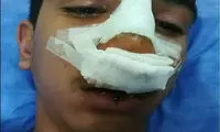 بازداشت عامل ضرب و شتمِ دانش آموز جیرفتی