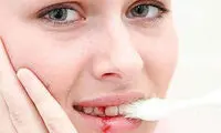 اگر این نشانه ها را دارید، ویتامین بخورید