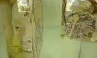 عکس: موزه پزشکی ترسناک در بانکوک (18+)