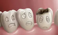 راه‌هایی برای پیشگیری از پوسیدگی دندان