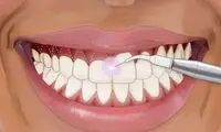 لیفت لثه (کانتورینگ) چیست و طی چه مراحلی انجام می شود؟