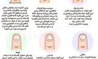 اینفوگرافی؛ شخصیت شناسی با شکل ناخن