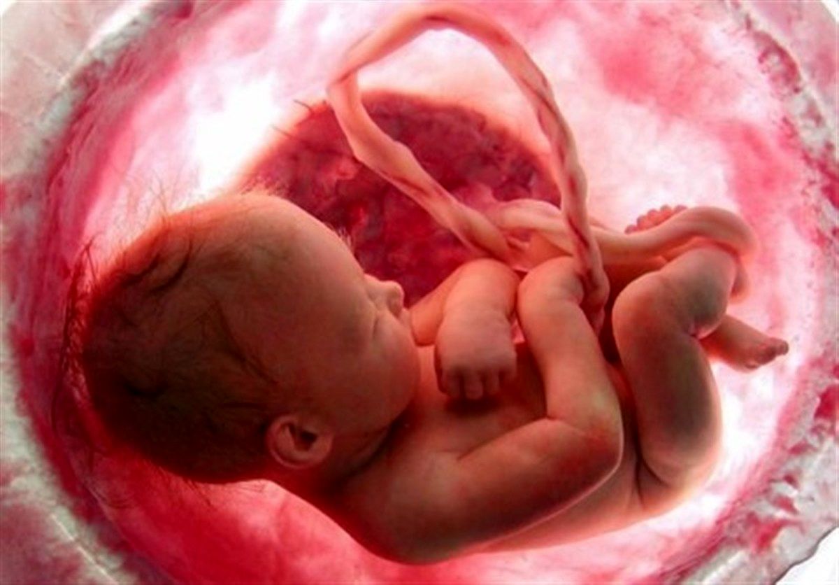 حبس و ابطال پروانه پزشکی برای سقط جنین 