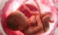 حبس و ابطال پروانه پزشکی برای سقط جنین 