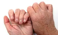 با خشکی پوست دست‌ بعد از خانه‌تکانی چه‌ کنیم؟
