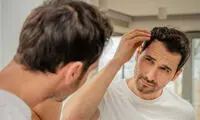 موفقیت بی‌سابقه برای مقابله با کچلی