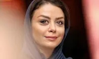 تغییر چهره شدید خانم بازیگر پس از عمل زیبایی