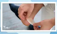 چطور تاول پوست را درمان کنیم؟