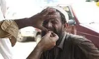 دندان‌پزشک خیابانی در پاکستان با نرخ ۵ دلار