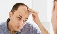 چند راهکار ساده برای جلوگیری از ریزش مو