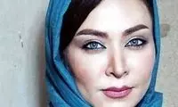 تصاویر توجه‌برانگیز از فقیهه سلطانی قبل از عمل زیبایی