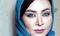 تصاویر توجه‌برانگیز از فقیهه سلطانی قبل از عمل زیبایی