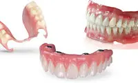 قیمت دندان مصنوعی ثابت بر پایه ایمپلنت چقدر است؟