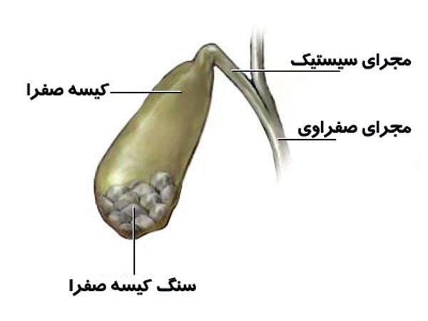 علائمی که نشان می‌دهد کیسه صفرای شما مشکل دارد