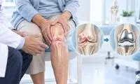 چه زمانی تعویض مفصل زانو ضروری است؟ بررسی علائم و شرایط بیمار