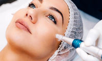 میکرونیدلینگ جای جوش و اسکار چگونه انجام می‌شود؟