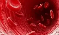 شایع ترین نوع کم‌خونی کدام است؟