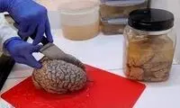 ببینید؛ اینجا ۱۰هزار مغز انسان نگهداری می‌شود!