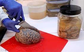 ببینید؛ اینجا ۱۰هزار مغز انسان نگهداری می‌شود!