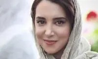 تغییر چهره عجیب خانم بازیگر سریال‌های مهران مدیری