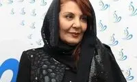 تغییر چهره خانم بازیگر مسن سوژه شد