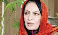 تغییر چهره اساسی خانم بازیگر سوژه شد