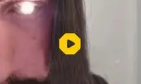 این مرد چشم خود را با چراغ قوه جایگزین کرد!