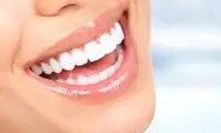 ایرانی‌ها قید دندان‌های خود را زدند!