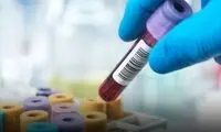 تشخیص فوری سرطان پروستات فقط در ۱۵ دقیقه!