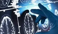 یک داروی گیاهی مفید علیه آلزایمر