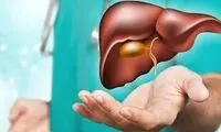 آنچه باید از سنگ کیسه صفرا بدانید