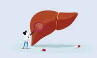 برای پاکسازی کبد این پنج توصیه را جدی بگیرید